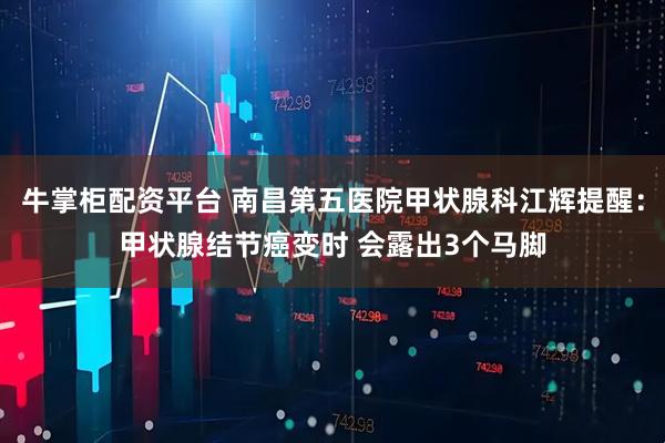 牛掌柜配资平台 南昌第五医院甲状腺科江辉提醒：甲状腺结节癌变时 会露出3个马脚